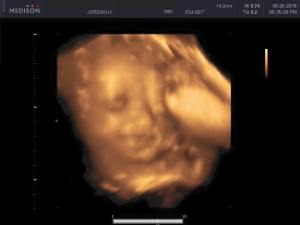 10686612_10153014450538038_7651750796255870187_n