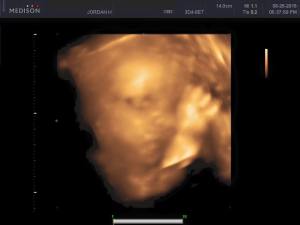 11934971_10153014450323038_3708321272206091481_n